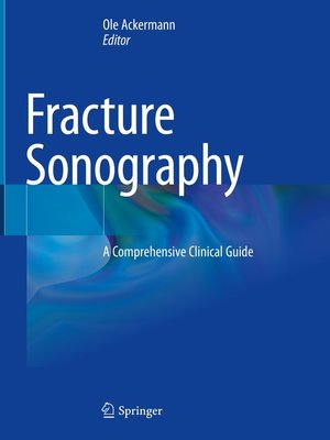 cover image of Fracture Sonography
